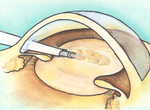 �����������̂𒴉��g�ŏ������ӂ��Ȃ���z��